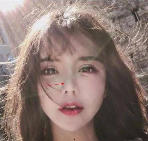 网红晓冉整容事件,揭秘美丽背后的代价