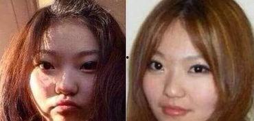 爆料小猪整容视频大全下载,视频大全下载一览